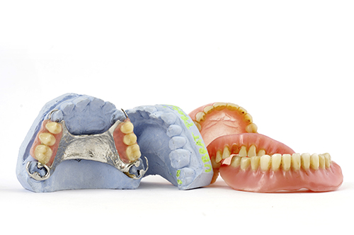 Selection of Lab Mold Dentures and their molds